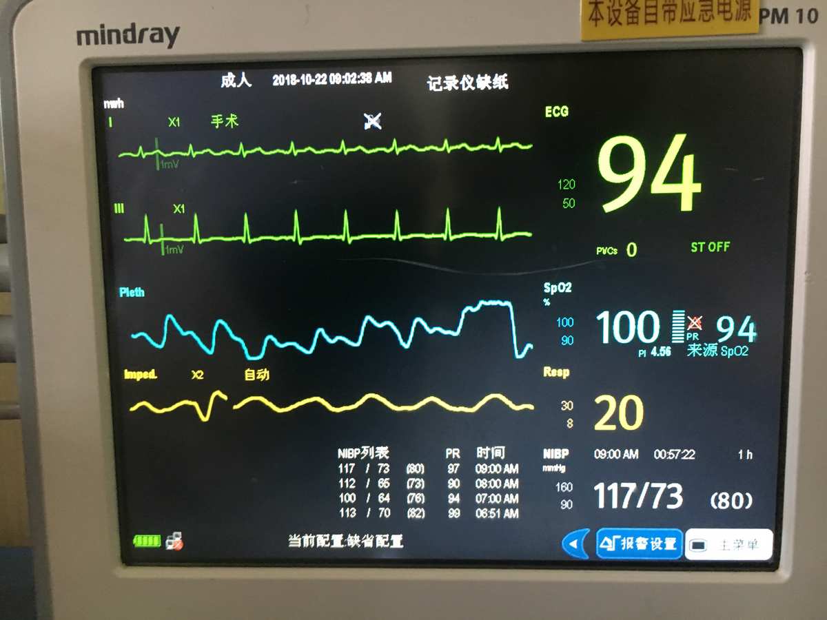 奇经八脉：中医师的秘密武器  第3张